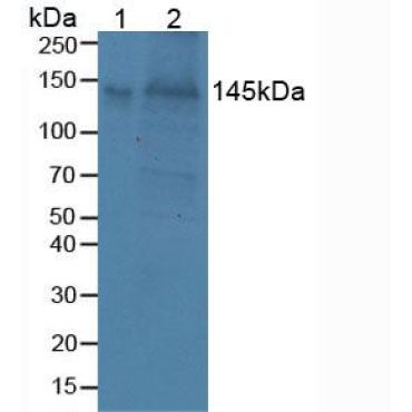 Brevican (BCAN) Mouse Polyclonal Antibody