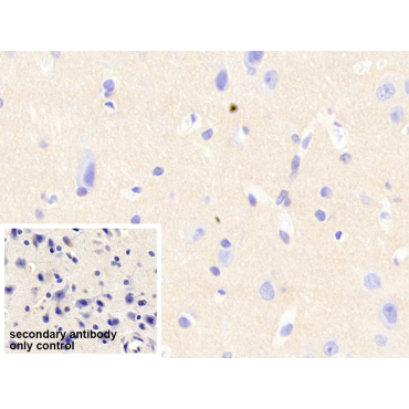 Neurocan (NCAN) Human Polyclonal Antibody