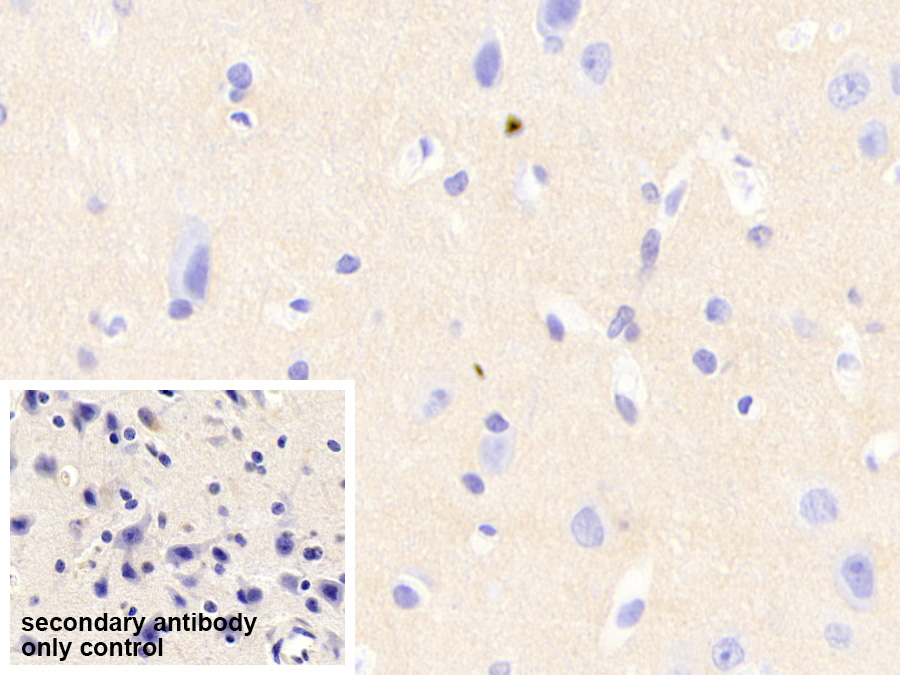 Neurocan (NCAN) Human Polyclonal Antibody