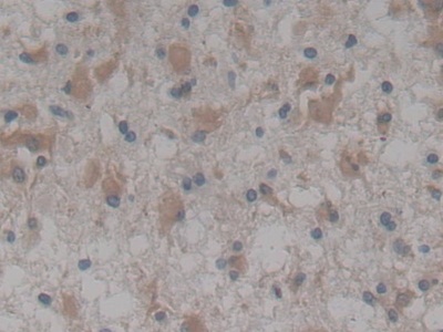 Neurotrophic Tyrosine Kinase Receptor Type 3 (NTRK3) Human Polyclonal Antibody