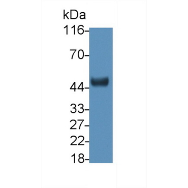 Ciliary Neurotrophic Factor Receptor (CNTFR) Human Polyclonal Antibody