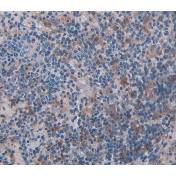 Adrenergic Receptor Beta Kinase 2 (ADRbK2) Human Polyclonal Antibody