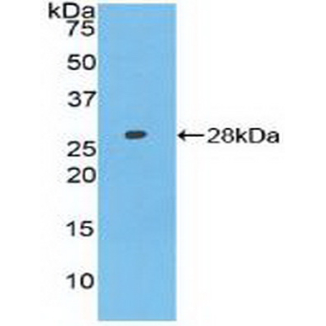 Axis Inhibition Protein (AXIN) Human Polyclonal Antibody