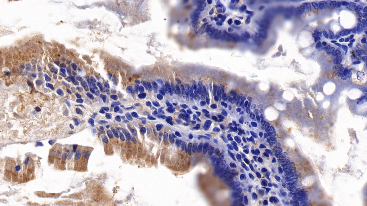Axis Inhibition Protein (AXIN) Rat Polyclonal Antibody