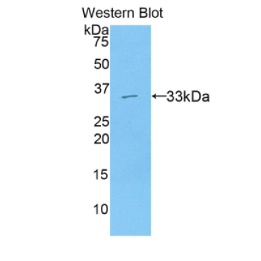 Axis Inhibition Protein 2 (AXIN2) Human Polyclonal Antibody