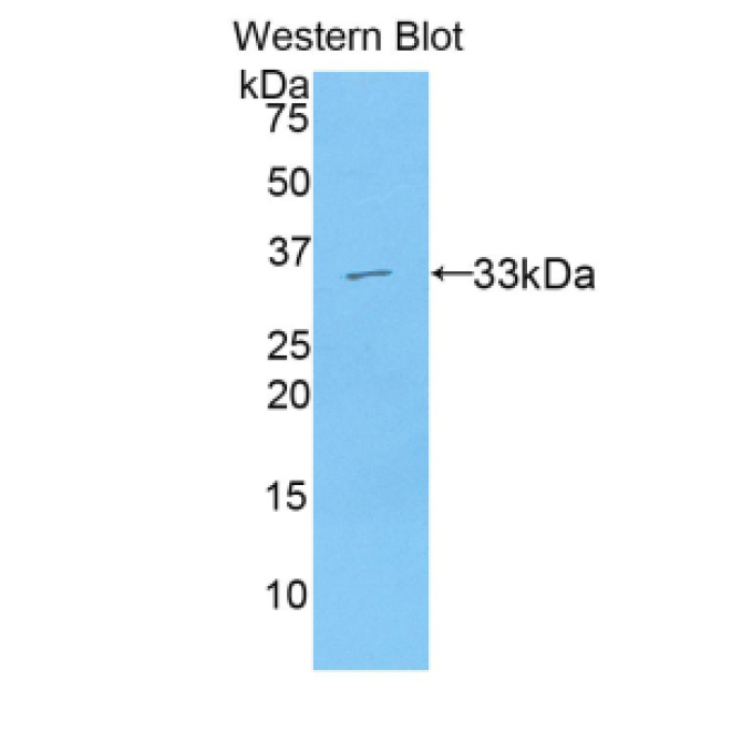 Axis Inhibition Protein 2 (AXIN2) Human Polyclonal Antibody