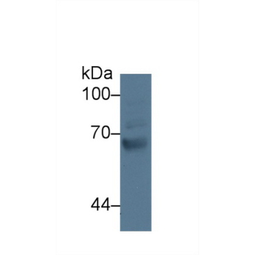 G Protein Coupled Receptor Kinase 4 (GRK4) Human Polyclonal Antibody
