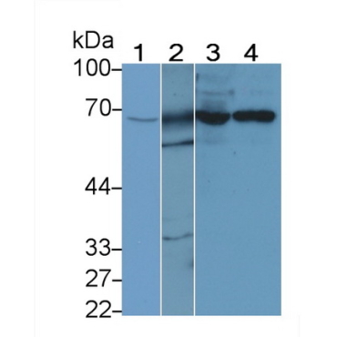G Protein Coupled Receptor Kinase 6 (GRK6) Human Polyclonal Antibody