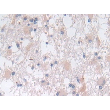 Sorting Nexin 13 (SNX13) Human Polyclonal Antibody
