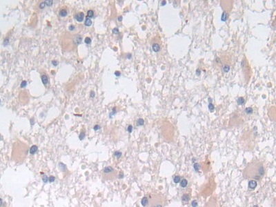 Sorting Nexin 13 (SNX13) Human Polyclonal Antibody