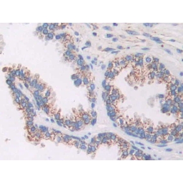 A Kinase Anchor Protein 11 (AKAP11) Human Polyclonal Antibody