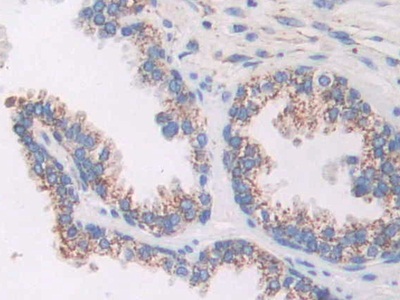 A Kinase Anchor Protein 11 (AKAP11) Human Polyclonal Antibody