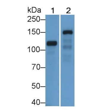 Desmoglein 2 (DSG2) Human Polyclonal Antibody