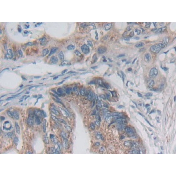 Desmoplakin (DSP) Human Polyclonal Antibody