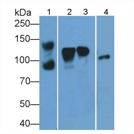 Amphiphysin (AMPH) Human Polyclonal Antibody