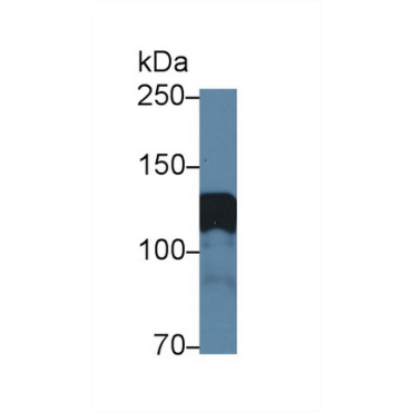 Amphiphysin (AMPH) Mouse Polyclonal Antibody