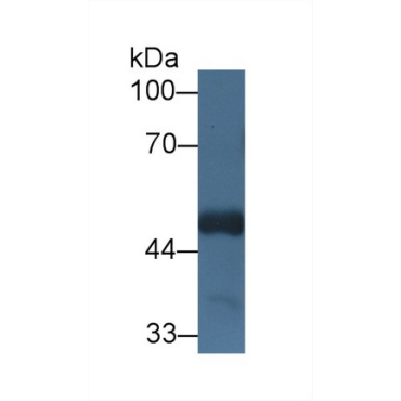Host Cell Factor C1 (HCFC1) Human Polyclonal Antibody