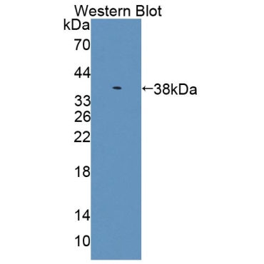 Embryonic Ectoderm Development (EED) Human Polyclonal Antibody