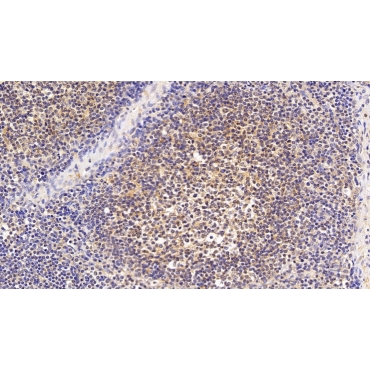 E1A Binding Protein P300 (EP300) Human Polyclonal Antibody