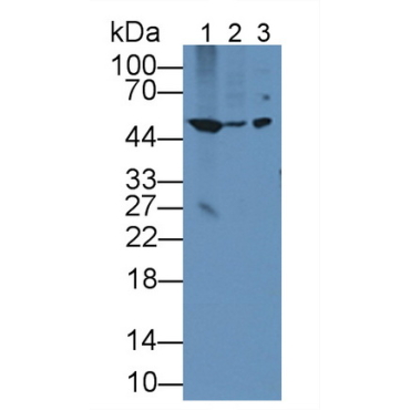 Bleomycin Hydrolase (BLMH) Human Polyclonal Antibody