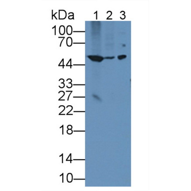Bleomycin Hydrolase (BLMH) Human Polyclonal Antibody
