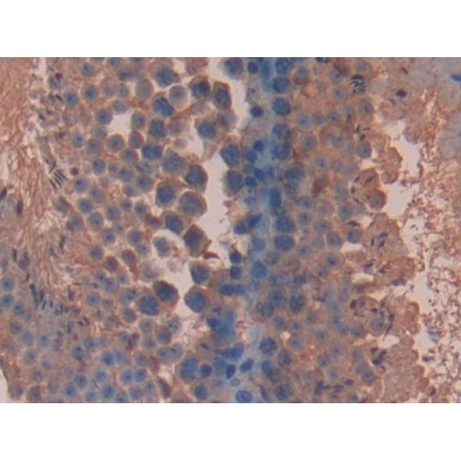 Bleomycin Hydrolase (BLMH) Mouse Polyclonal Antibody