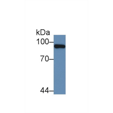 Promyelocytic Leukemia Protein (PML) Human Polyclonal Antibody