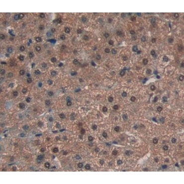 Atrophin 1 (ATN1) Human Polyclonal Antibody
