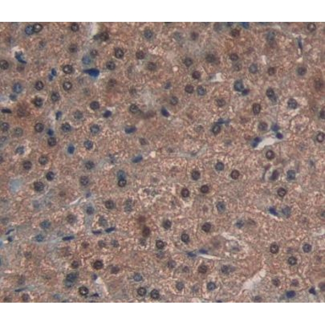 Atrophin 1 (ATN1) Human Polyclonal Antibody
