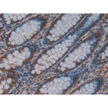 C-Raf Proto Oncogene Serine/Threonine Protein Kinase (Raf-1) Human Polyclonal Antibody