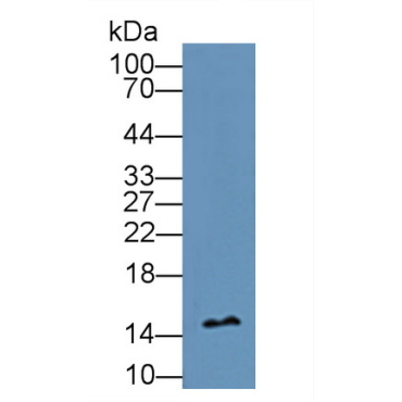 Profilin 1 (PFN1) Human Polyclonal Antibody