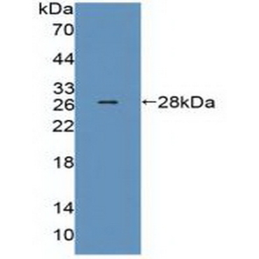 Mediator Complex Subunit 1 (MED1) Human Polyclonal Antibody
