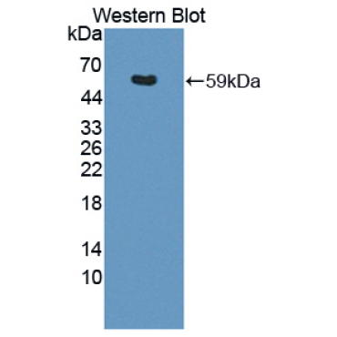 Thyroid Hormone Receptor Alpha (THRa) Human Polyclonal Antibody