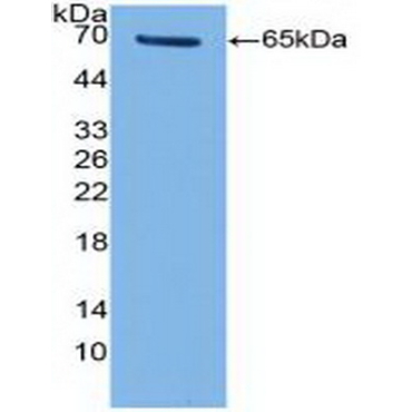 Telomerase Reverse Transcriptase (TERT) Human Polyclonal Antibody