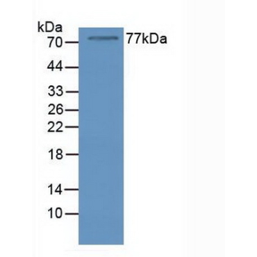 Nucleolin (NCL) Human Polyclonal Antibody