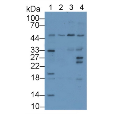 Wilms Tumor 1 Associated Protein (WTAP) Human Polyclonal Antibody