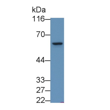 Phosphoinositide Dependent Protein Kinase 1 (PDPK1) Human Polyclonal Antibody