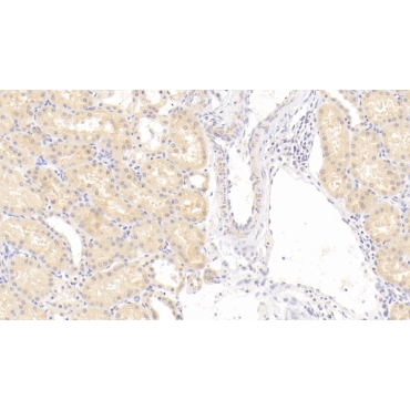 Deoxyribonuclease II (DNASEII) Human Polyclonal Antibody