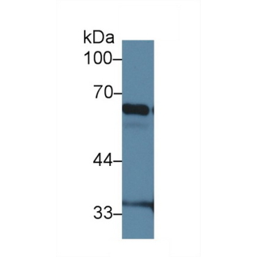 Inhibitory Subunit Of NF Kappa B Zeta (IkBz) Mouse Polyclonal Antibody