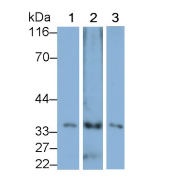 Pirin (PIR) Human Polyclonal Antibody