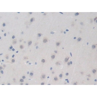 Bromodomain Containing Protein 8 (BRD8) Mouse Polyclonal Antibody