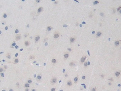 Bromodomain Containing Protein 8 (BRD8) Mouse Polyclonal Antibody