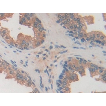 Ubiquitin Specific Peptidase 7 (USP7) Human Polyclonal Antibody