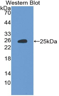 Tight Junction Protein 1 (TJP1) Human Polyclonal Antibody