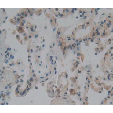 Centromere Protein J (CENPJ) Human Polyclonal Antibody