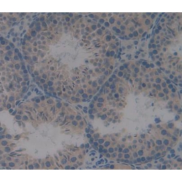 Centromere Protein J (CENPJ) Mouse Polyclonal Antibody