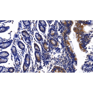 Erythrocyte Membrane Protein Band 4.1 (EPB41) Human Polyclonal Antibody
