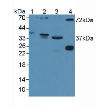 Disrupted In Schizophrenia 1 (DISC1) Human Polyclonal Antibody