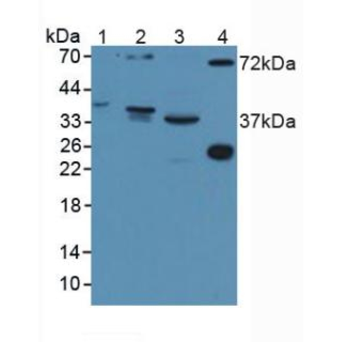 Disrupted In Schizophrenia 1 (DISC1) Human Polyclonal Antibody