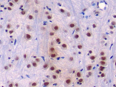 Disrupted In Schizophrenia 1 (DISC1) Rat Polyclonal Antibody